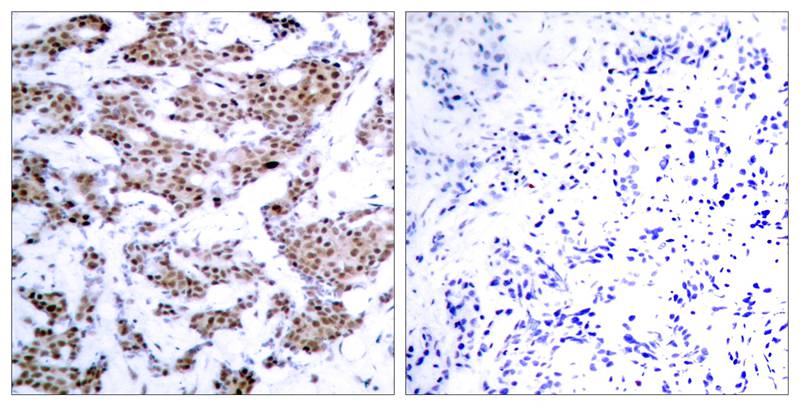 MEF2a(Phospho-Thr312) Antibody