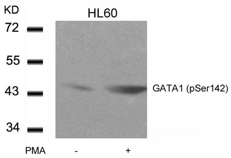 GATA1(Phospho-Ser142) Antibody