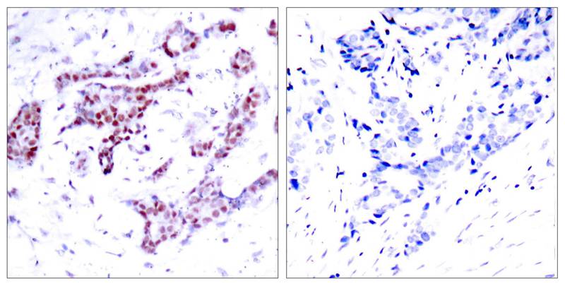 STAT1(Phospho-Tyr701) Antibody