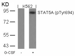 STAT5a(Phospho-Tyr694) Antibody
