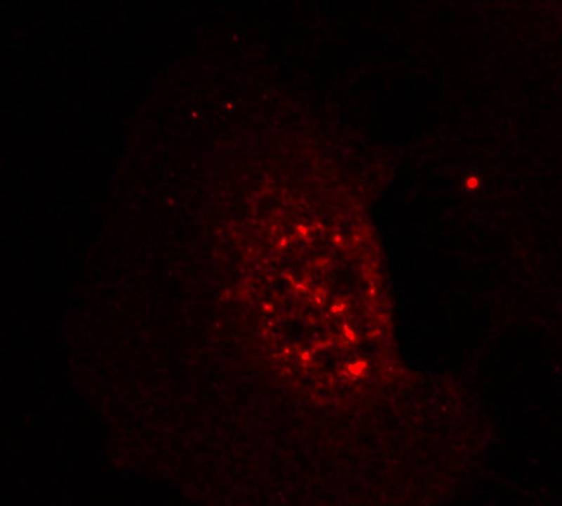 Akt(Phospho-Thr308) Antibody