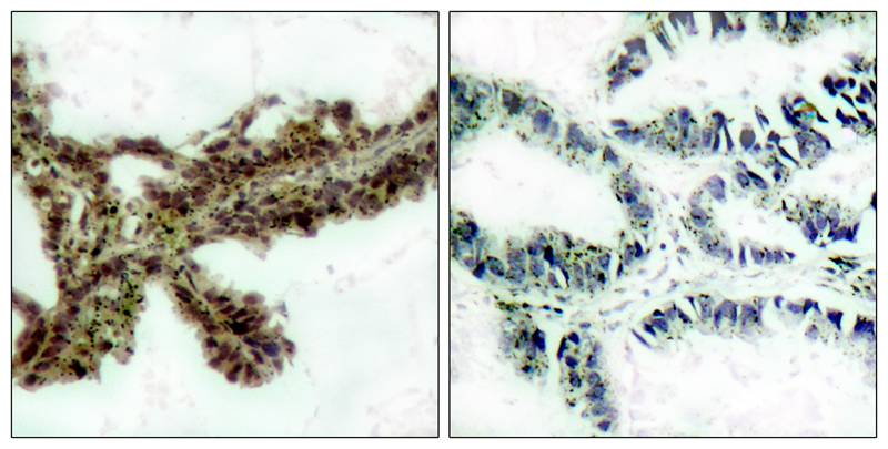 Akt(Phospho-Thr308) Antibody