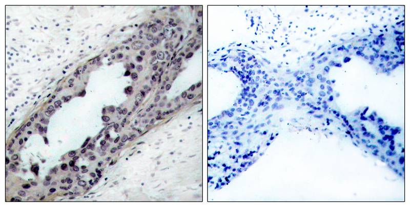 PTEN(Phospho-Ser380/Thr382/Thr383) Antibody