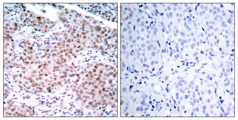 Estrogen Receptor-a(Phospho-Ser104) Antibody