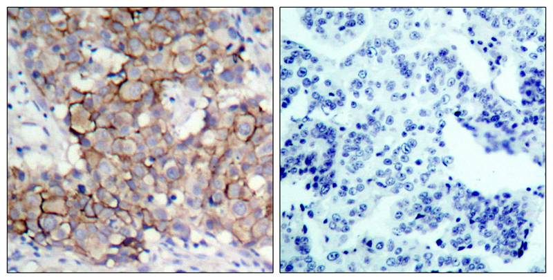 HER2(Phospho-Tyr877) Antibody