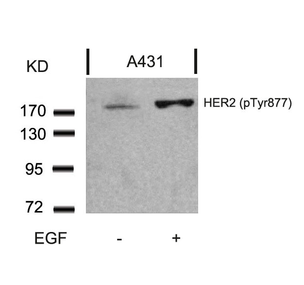 HER2(Phospho-Tyr877) Antibody - SAB | Signalway Antibody