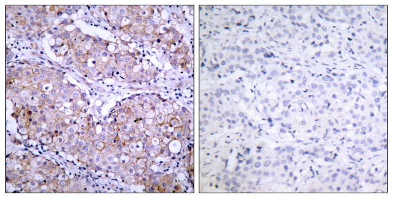 EGFR(Phospho-Ser1070) Antibody