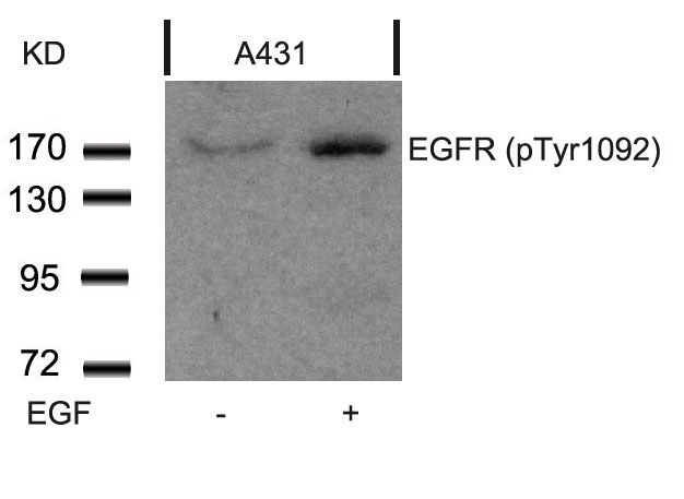 EGFR(Phospho-Tyr1092) Antibody