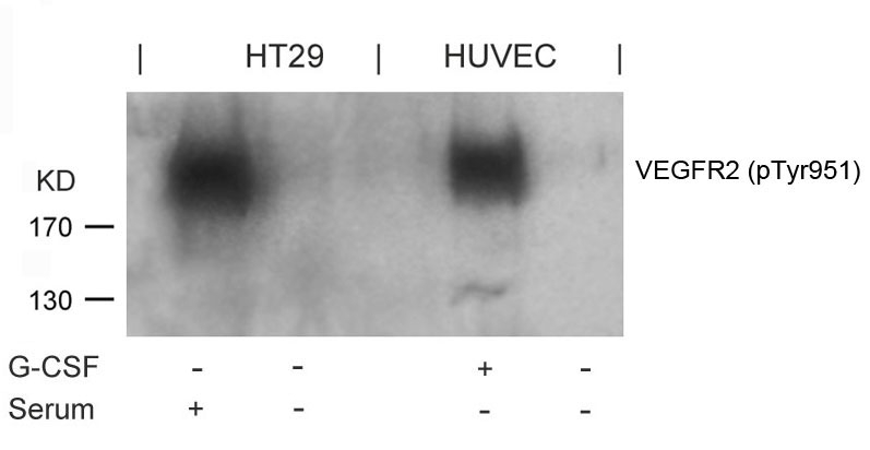 VEGFR2(Phospho-Tyr951) Antibody