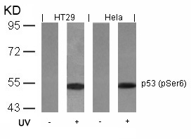 p53(Phospho-Ser6) Antibody