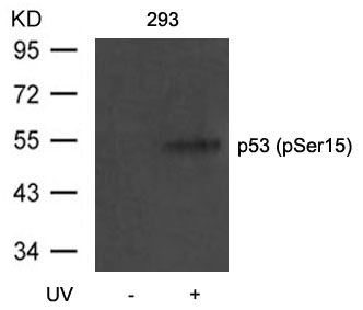 p53(Phospho-Ser15) Antibody