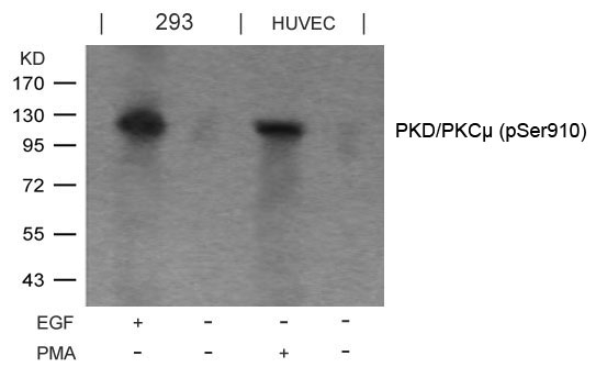 PKD/PKCm(Phospho-Ser910) Antibody