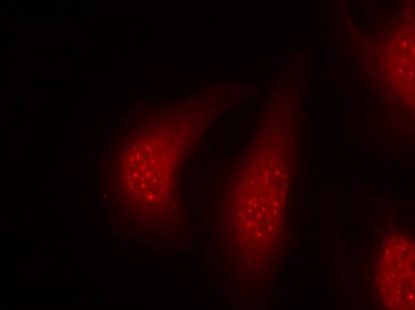 p90RSK(Phospho-Thr348) Antibody