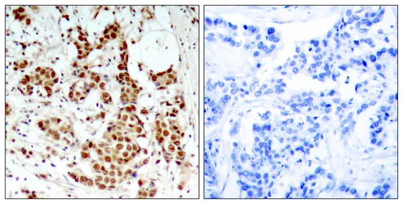 p90RSK(Phospho-Thr348) Antibody