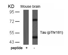 Tau(Phospho-Thr181) Antibody