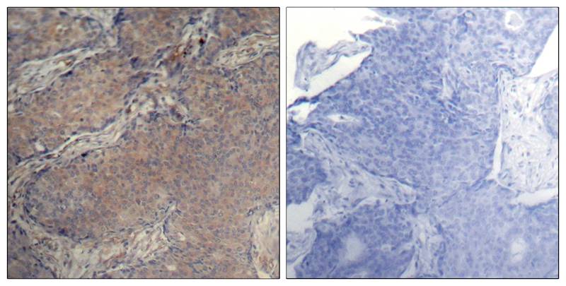 Myosin Light Chain 2 (Phospho-Ser19) Antibody