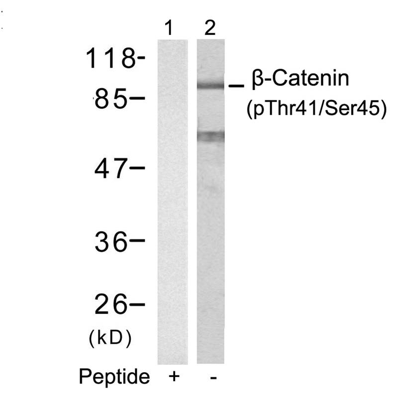 b-Catenin(Phospho-Thr41/Ser45) Antibody