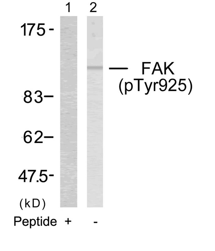 FAK(Phospho-Tyr925) Antibody