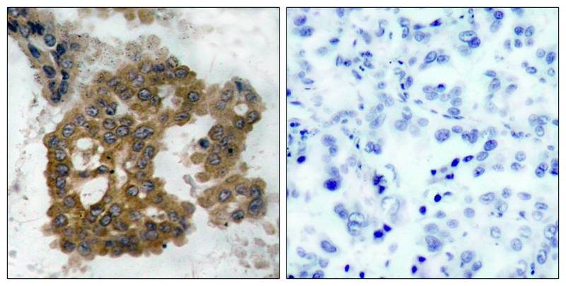 Akt2(Phospho-Ser474) Antibody