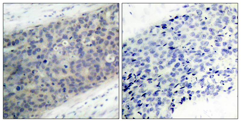 LIMK2(Phospho-Thr505) Antibody