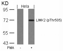 LIMK2(Phospho-Thr505) Antibody
