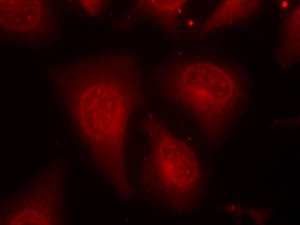 HDAC8(Phospho-Ser39) Antibody