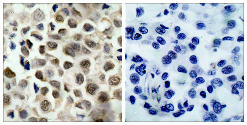 HDAC8(Phospho-Ser39) Antibody