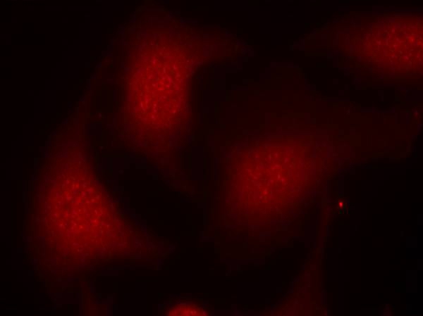 Rb(Phospho-Ser795) Antibody