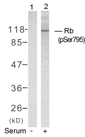 Rb(Phospho-Ser795) Antibody