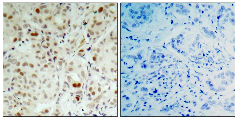 Rb(Phospho-Ser807) Antibody