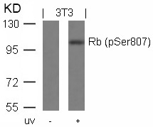 Rb(Phospho-Ser807) Antibody