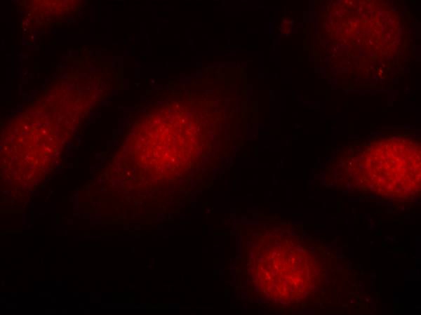 Rb(Phospho-Ser780) Antibody