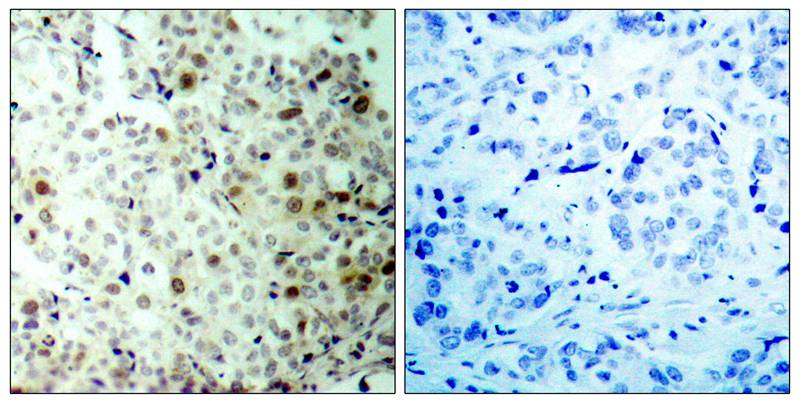 CDK2(Phospho-Thr160) Antibody