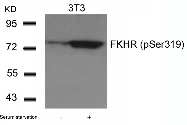 FKHR(Phospho-Ser319) Antibody