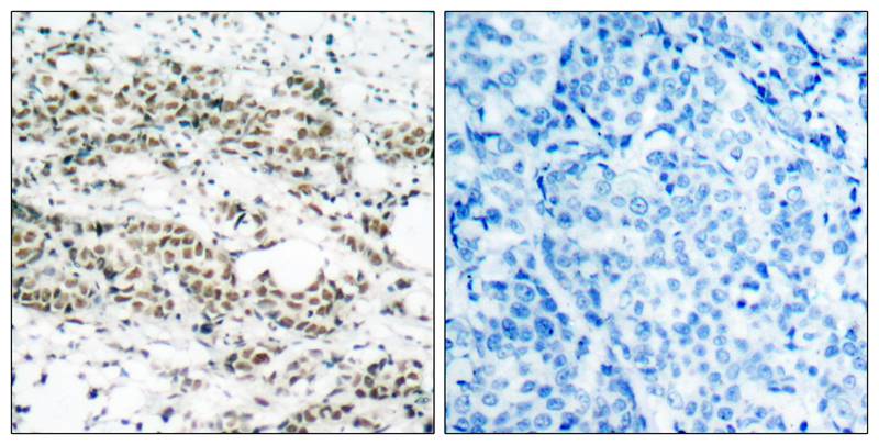 AFX(Phospho-Ser197) Antibody