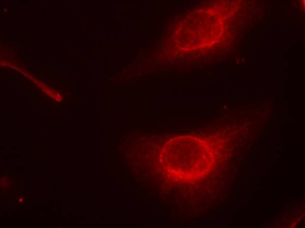 cofilin(Phospho-Ser3) Antibody