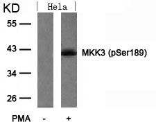 MKK3(Phospho-Ser189) Antibody