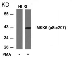 MKK6(Phospho-Ser207) Antibody