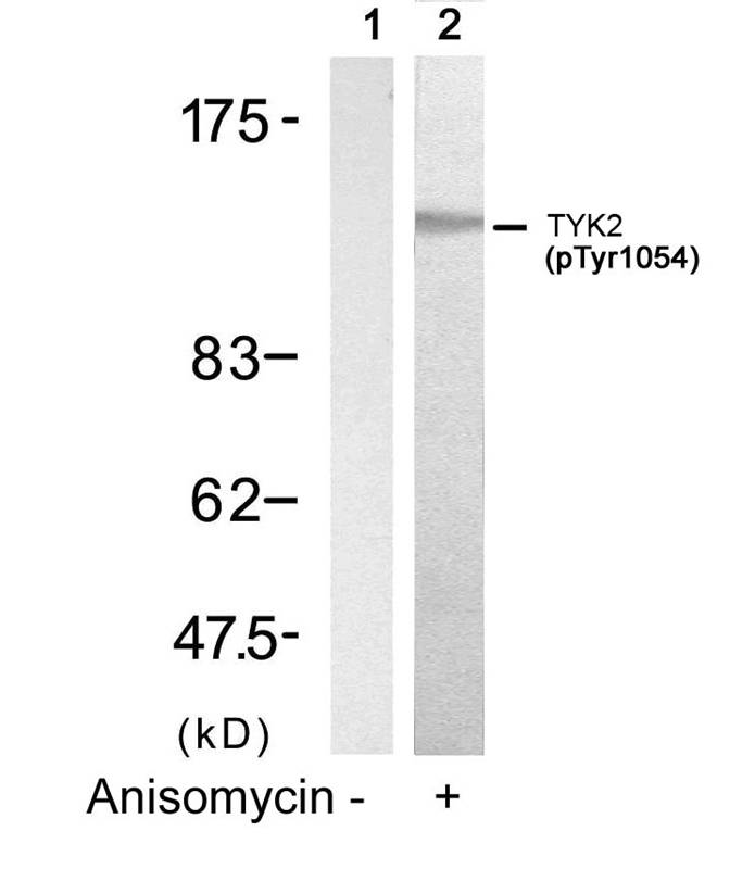 TYK2(Phospho-Tyr1054) Antibody