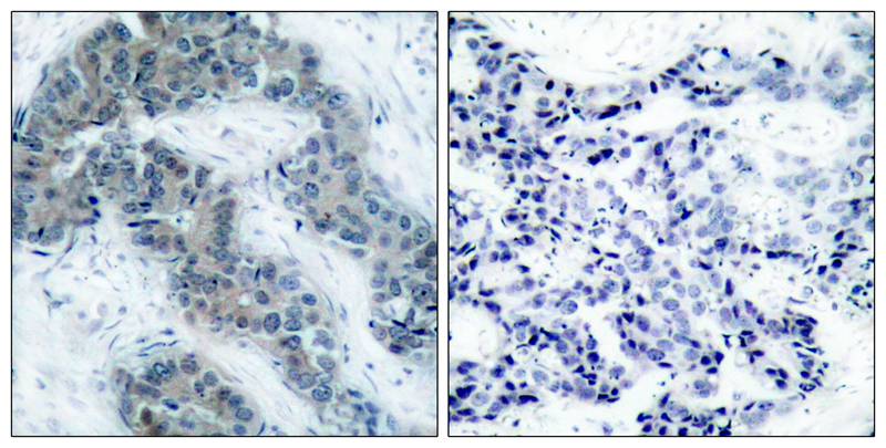 Jak2(Phospho-Tyr1007) Antibody