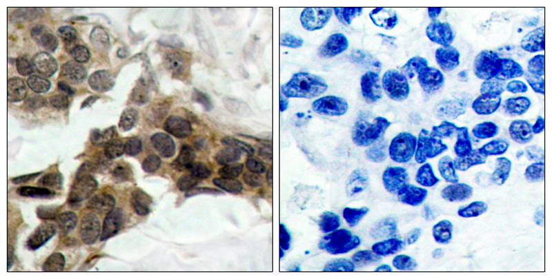 IkB-a(Phospho-Ser32/Ser36) Antibody