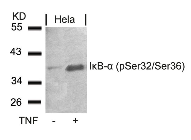 IkB-a(Phospho-Ser32/Ser36) Antibody