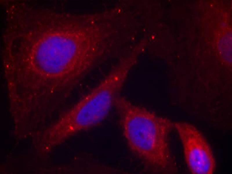 PAK1(Phospho-Thr212) Antibody