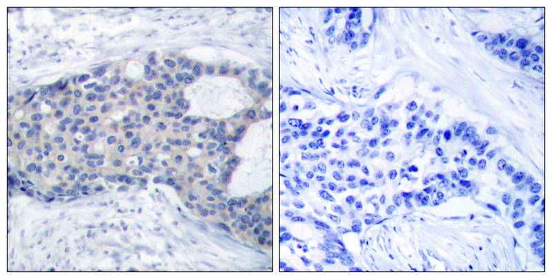 Zap-70(Phospho-Tyr493) Antibody