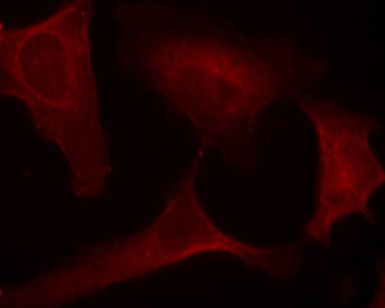 MEK1(Phospho-Ser221) Antibody