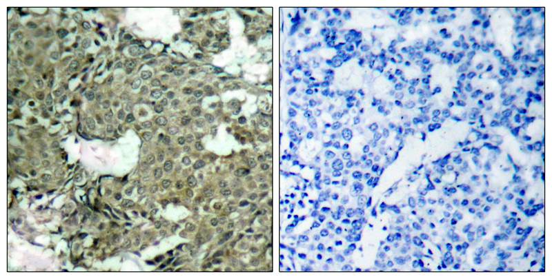 MEK1(Phospho-Ser221) Antibody