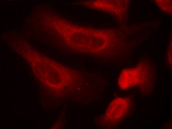 STAT1(Phospho-Ser727) Antibody