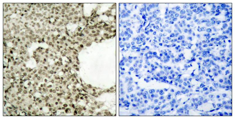 STAT1(Phospho-Ser727) Antibody