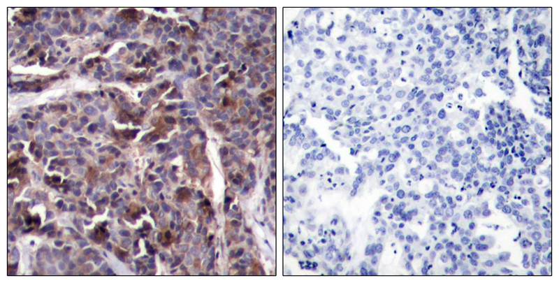 NFkB-p65(Phospho-Thr505) Antibody