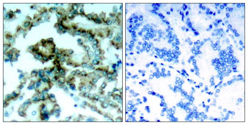 PKCb(Phospho-Thr641) Antibody